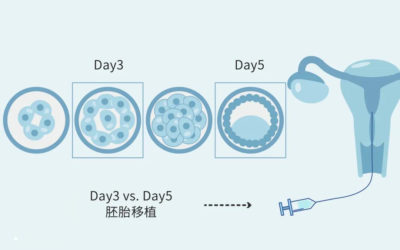 冷凍胚胎移植的好處有哪些？